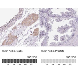 HSD17B3 Antibody, Novus Biologicals 0.1mL; Unlabeled:Antibodies, Polyclonal